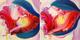 My Garden (Seed 10) - Diptych by Jitrin Thaothong